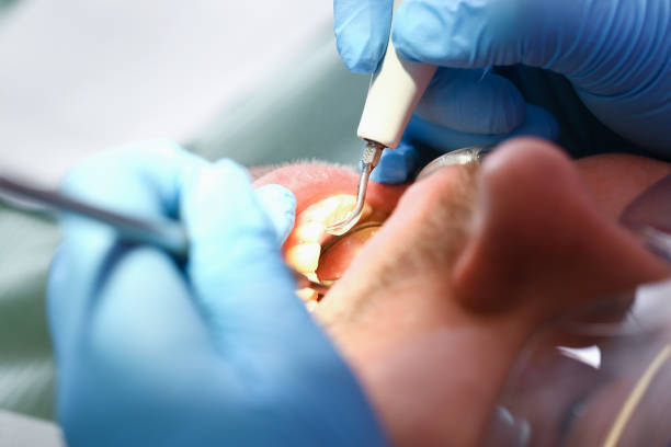 Best Emergency Treatment for Toothache in Canyon, TX